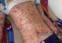 Menor muere por picaduras de abejas tras volcarse el bus en que viajaba, Jinotega