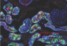 Los riñones femeninos son más resistentes.