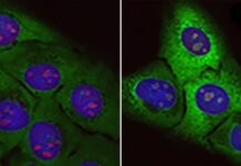 Posible origen de la esclerosis lateral amiotrófica