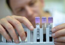 Un análisis de sangre podría predecir el párkinson siete años antes de los síntomas.