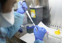 Argentina refuerza controles fronterizos ante la propagación de la viruela del mono.