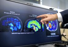 Científicos latinos en EEUU hallan un biomarcador que podría detectar temprano el alzhéimer