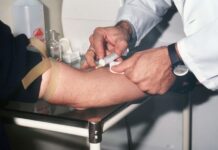 Un análisis genético podría detectar el párkinson antes de los primeros síntomas