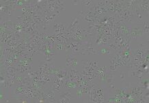 Descubren un mecanismo bacteriano que podría destruir células tumorales