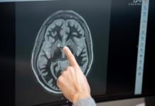 Logran medir la actividad cerebral de una paciente tratada con un fármaco antiobesidad