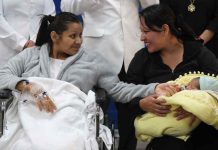 Perú, nacimiento de un embarazo ectópico con bebé en el hígado