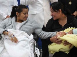 Perú, nacimiento de un embarazo ectópico con bebé en el hígado